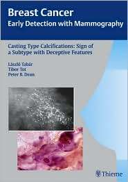 Casting Type Calcifications Sign of a Subtype with Deceptive Features 