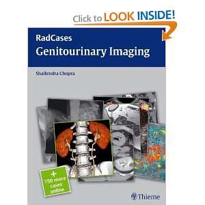   Genitourinary Imaging (Radcase) [Paperback] Shailendra Chopra Books