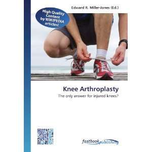  Knee Arthroplasty The only answer for injured knees 