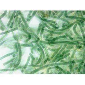 Tolypothrix, a False Branching Cyanobacteria Containing Heterocysts 