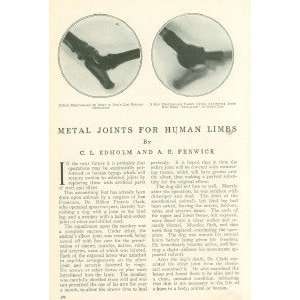   1913 Dr Milton Francis Clark Artificial Limbs Joints 