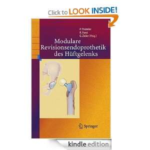Modulare Revisionsendoprothetik des Hüftgelenks (German Edition 