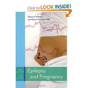  Epilepsy And Pregnancy [Paperback] Stacey Chillemi Books