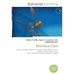  Meniscal Cyst (9786134094474) Books