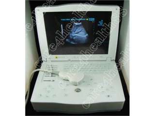   ultrasound scanner laptop with 3 optional probes laptop ultrasound